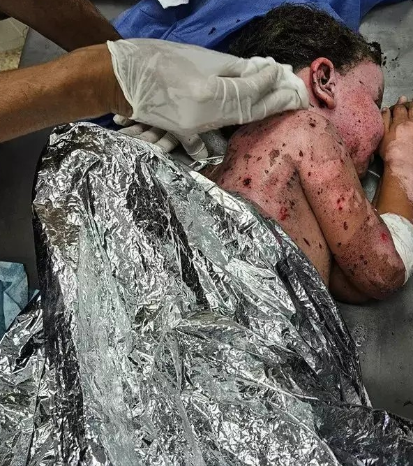 İsrail, Gazze'de yardım için toplanan çocukları vurdu