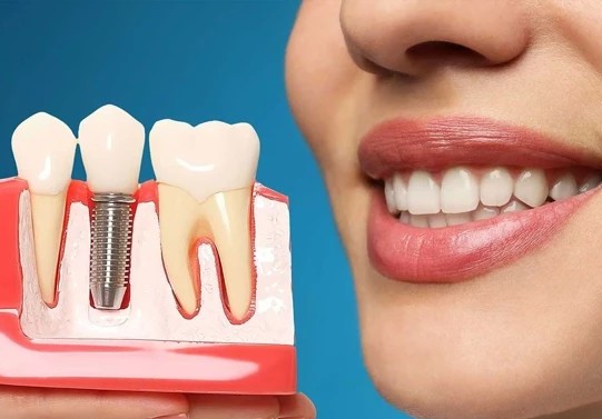 İmplant SSK kapsamına mı giriyor